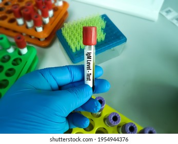 Blood Sample Tube For Immunoglobulin M Or IgM Level Test, Diagnosis For Immunodeficiency Disease