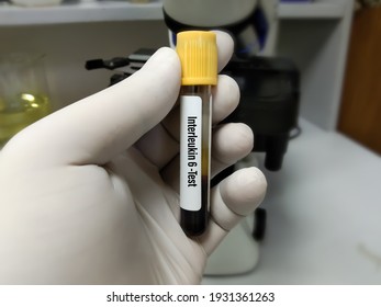 Blood Sample Tube For Interleukin 6 Or IL-6 Test, Pro-inflammatory Cytokine And Anti-inflammatory Myokine