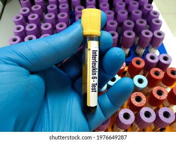 Blood Sample Tube For Interleukin 6 Or IL-6 Test, Pro-inflammatory Cytokine And Anti-inflammatory Myokine