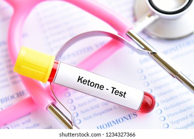 Blood Sample Tube For Ketone Test, Diagnosis For Diabetic Ketoacidosis