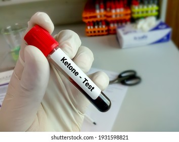 Blood Sample Tube For Ketone Test, Diagnosis Of Diabetic Ketoacidosis 