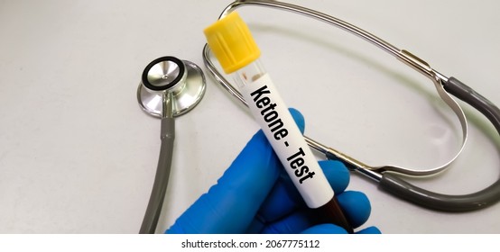 Blood Sample Tube For Ketone Test, Diagnosis For Diabetic Ketoacidosis