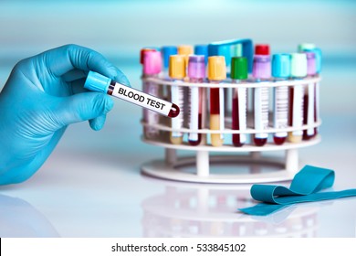 Blood Sample Tube Labeled Text Blood Stock Photo 533845102 | Shutterstock