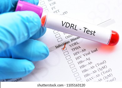 75 Rpr Test Images, Stock Photos & Vectors | Shutterstock