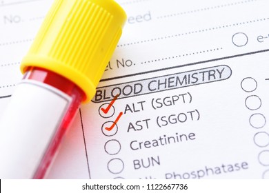 Blood Sample Tube With Laboratory Requisition Form For Liver Enzyme Test