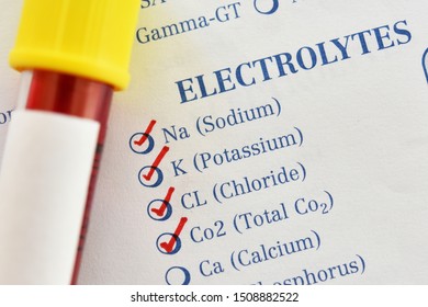 Electrolyte Test Images Stock Photos Vectors Shutterstock