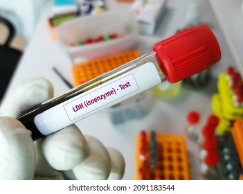 Blood Sample Tube Ldh Isoenzyme Test Stock Photo (Edit Now) 2091183544