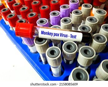 Blood sample tube for Monkeypox virus test. It is also known as the Moneypox virus, is a double-stranded DNA, zoonotic virus and a species of the genus Orthopoxvirus in the family Poxviridae