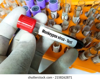 Blood sample tube for Monkeypox virus test. It is also known as the Moneypox virus, is a double-stranded DNA, zoonotic virus and a species of the genus Orthopoxvirus in the family Poxviridae