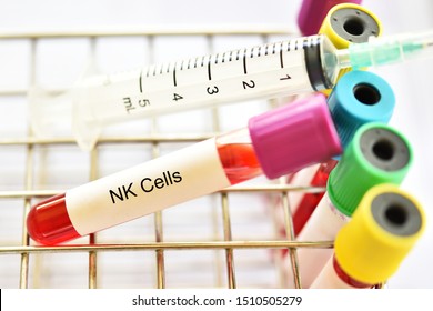 Blood Sample Tube For Natural Killer Cells Or NK Cells Test