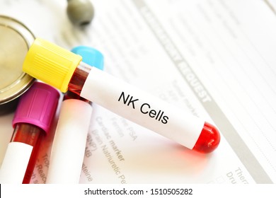 Blood Sample Tube For Natural Killer Cells Or NK Cells Test