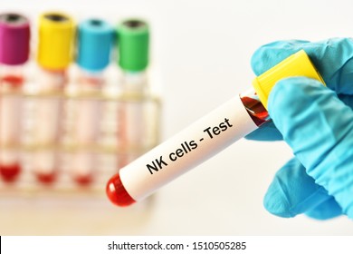 Blood Sample Tube For Natural Killer Cells Or NK Cells Test