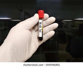 Blood Sample Tube For Natural Killer Cells Or NK Cells Test At Laboratory