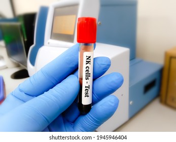 Blood Sample Tube For Natural Killer Cells Or NK Cells Test At Laboratory