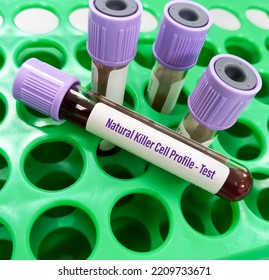 Blood Sample Tube For Natural Killer(NK) Cells Profile - Test, Large Granular Lymphocytes.