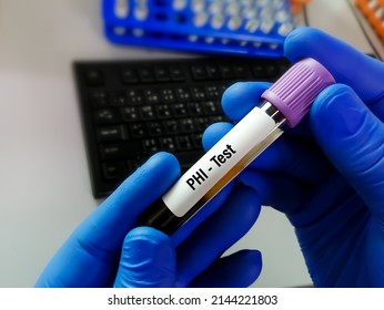 Blood sample tube with sample for PHI (Prostate Health Index) test for prostate cancer. A combination test of Prostate specific antigen including total PSA, free PSA and p2PSA.