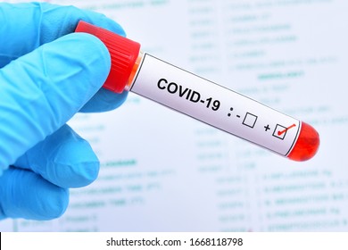 Blood sample tube positive with COVID-19 virus or novel coronavirus 2019 found in Wuhan, China
