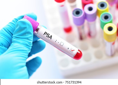 Blood sample tube positive with PSA