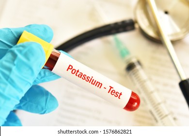 Blood Sample Tube For Potassium Test