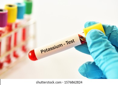 Blood Sample Tube For Potassium Test