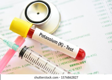 Blood Sample Tube For Potassium Test