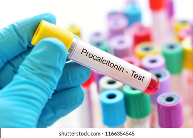 Blood Sample Tube For Procalcitonin Test, Diagnosis For Severe Sepsis