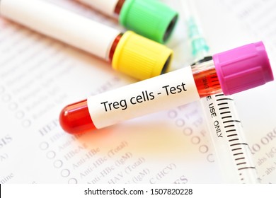 Blood Sample Tube For Regulatory T Cells Or Treg Cells Test