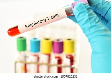 Blood Sample Tube For Regulatory T Cells Or Treg Cells Test