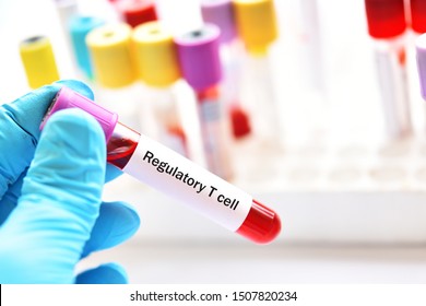 Blood Sample Tube For Regulatory T Cells Or Treg Cells Test