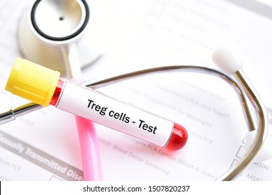 Blood Sample Tube For Regulatory T Cells Or Treg Cells Test