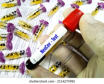 Blood Sample Tube For SARS-COV-2, Covid-19 New Variant NeoCov Test. Wuhan Scientists Warn Of New Type Of Coronavirus With High Death, Infection Rate