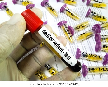 Blood Sample Tube For SARS-COV-2, Covid-19 New Variant NeoCov Test. Wuhan Scientists Warn Of New Type Of Coronavirus With High Death, Infection Rate