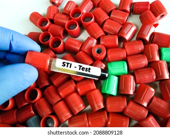 Blood Sample Tube For STI, Sexual Transmission Infection Test