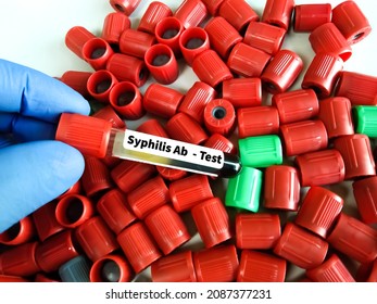 Blood Sample Tube For Syphilis Ab (antibody) Test.