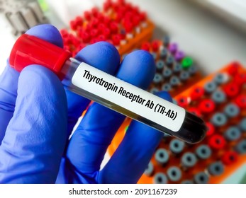 Blood Sample Tube For Thyrotropin Receptor Ab (TR-Ab) Test. To Diagnosis Autoimmune Thyrotoxicosis. Graves Disease, Hashimoto's Thyroiditis At Medical Laboratory.