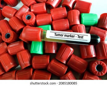 Blood Sample Tube For Tumor Marker Test