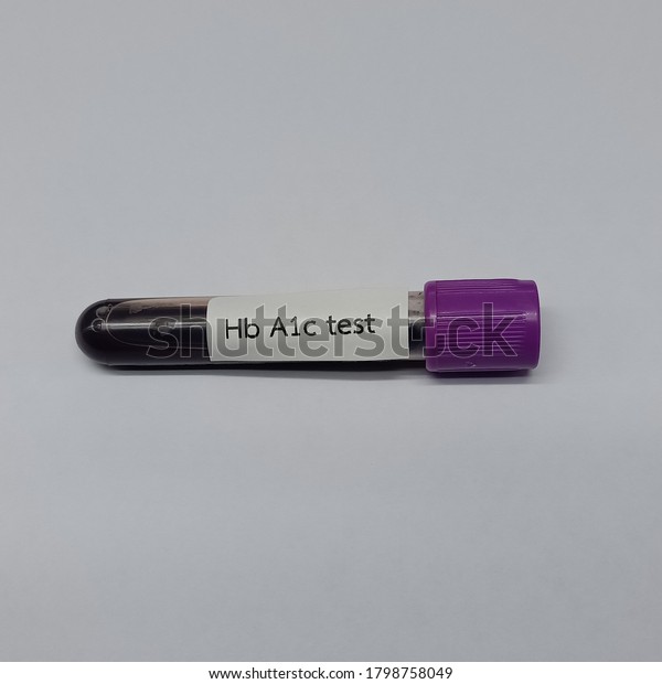 Blood Sample Tubes Glycohemoglobin Test Stock Photo 1798758049 ...