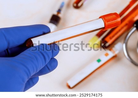 Blood sample tubes for laboratory testing in medical facility
