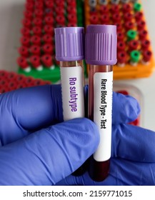 Blood Sample Tubes For Rare Blood Type (Ro Subtype) Test. Ro Subtype, Laboratory Background.