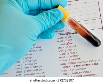 Blood Sample For Tumor Marker Testing