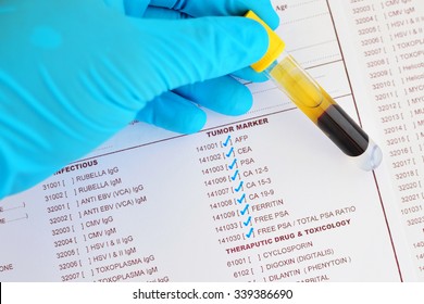 Blood Sample For Tumor Marker Testing