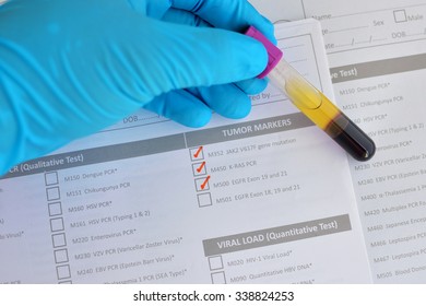 Blood Sample For Tumor Markers Testing By Molecular Method