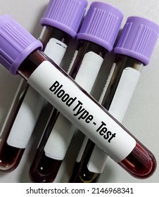 Blood sample for Blood type testing.