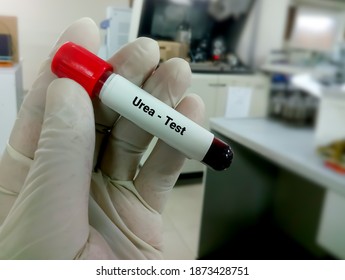 Blood Sample For Urea Test. Diagnosis Of Kidney Or Renal Disease