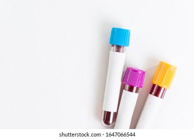 Blood Sample In Vacuum Tube Isolated On White Background. Top View.