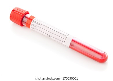 Blood Sample Vial With Blood Specimen On White Background