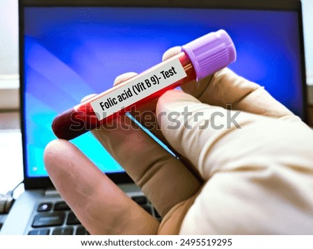 Blood sample for Vitamin B Complex (Niacin -B3, Biotin -B7 and Folic acid -B9) testing. To diagnosis vitamin B deficiency.