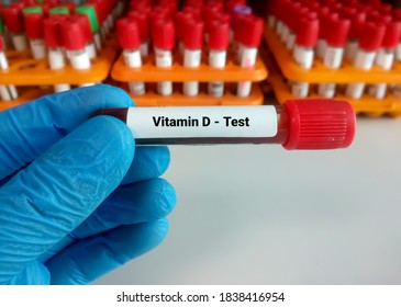 Blood Sample For Vitamin D Test With Laboratory Background. Close Up. Osteoporosis.