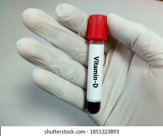 Blood Sample For Vitamin D Test