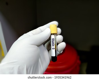 Blood Sample For Vitamin D Test